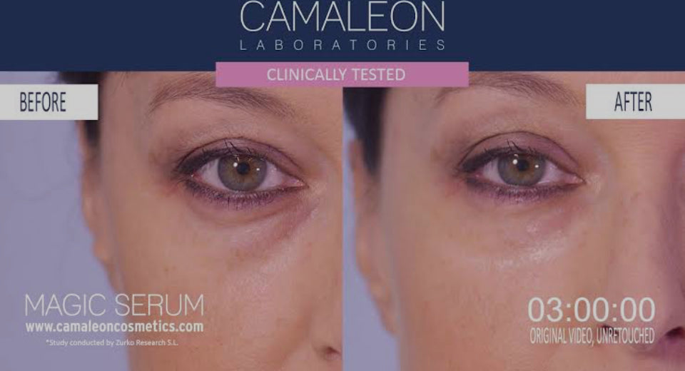 Magic sérum lift