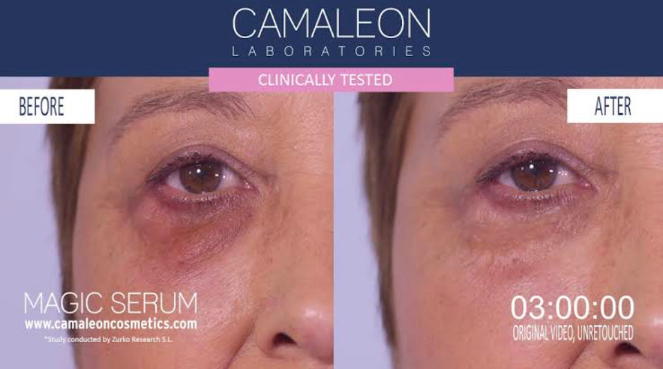 Magic sérum lift