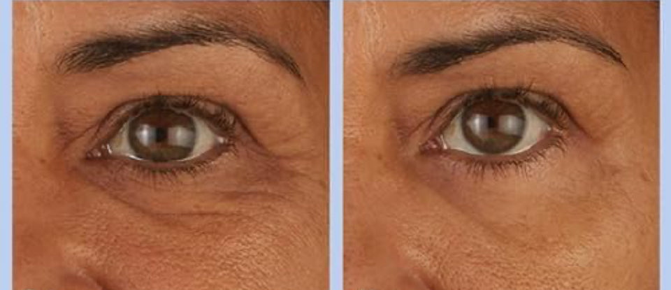 Magic sérum lift